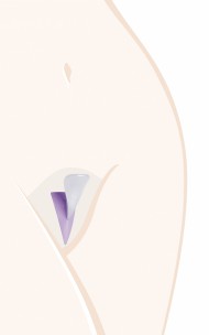 Ladyshape - Triangle Szablon do golenia w trójkącik